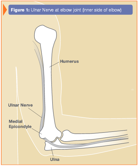 figure1-1