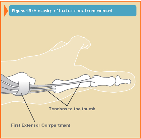 figure1b