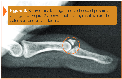 figure2-a