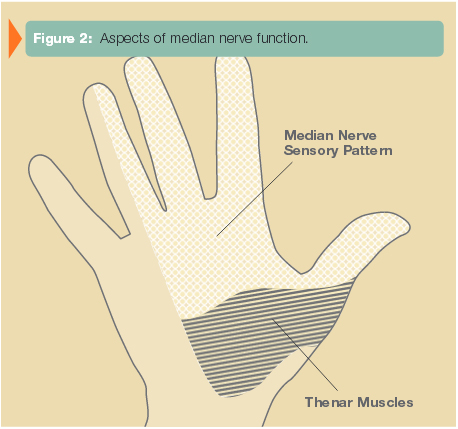 figure2