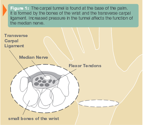 figure1