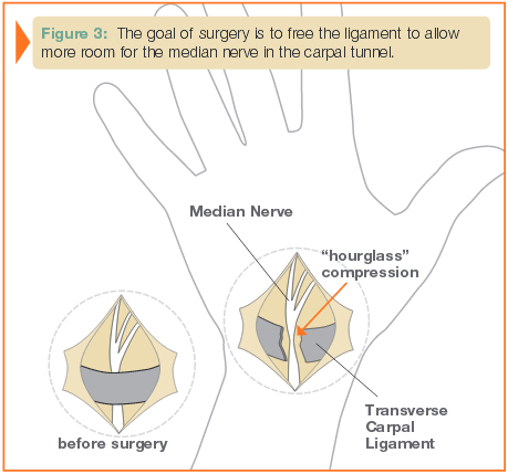 figure3